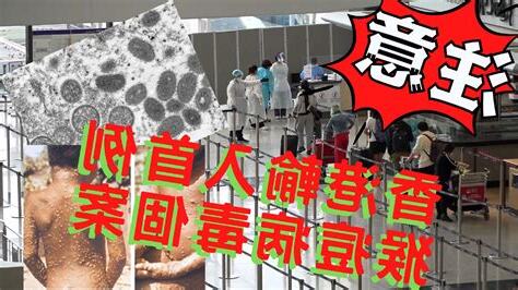 猴痘 香港